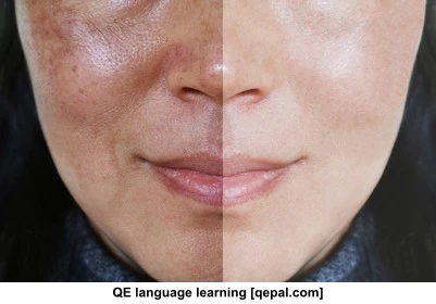 تصویر فلش کارت blemish