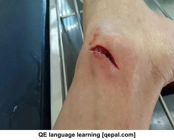 تصویر فلش کارت laceration
