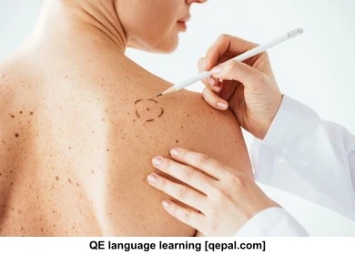 تصویر فلش کارت melanoma