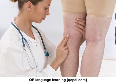 تصویر فلش کارت oedema
