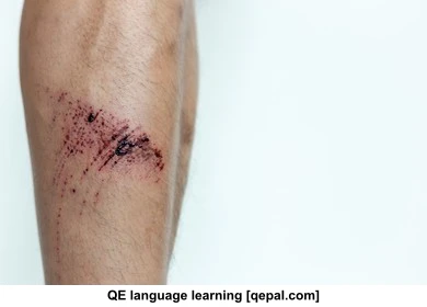 تصویر فلش کارت scab