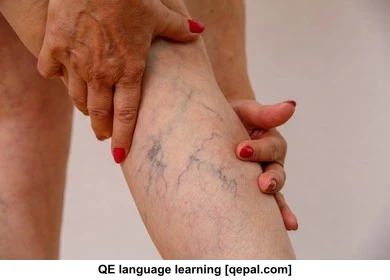 تصویر فلش کارت venous